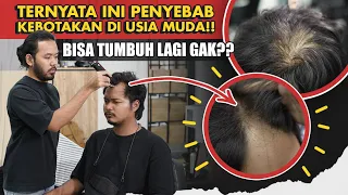 Masih Muda Kok Rambut Mulai TIPIS? Begini Cara Mengatasinya…
