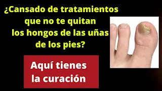 ¿Cansado de tratamientos que no te quitan los hongos de las uñas? Aquí tienes la curación