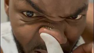 Nose Oil is very NORMAL | Safety Tips and Warning