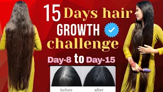 Day-8 to Day-15 | 15 days hair growth challenge | hair growth series अब आपके भी बाल होगे मजबूत #hair
