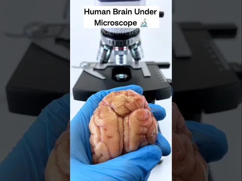 Human brain under the microscope 🔬 #shorts #youtubeshorts #shortvideo