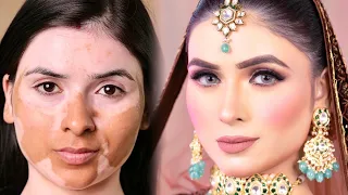 Vitiligo skin makeup tutorial by Sanya and Shifa