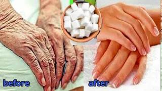 Sugar in 5 days remove wrinkles on hands and fingers completely get baby hands fast