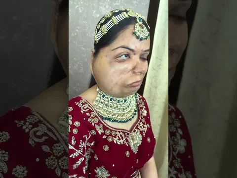 लड़की के चेहरे के साथ ये क्या हो गया 😱 Amezing Makeup 😍 | #shorts #makeup