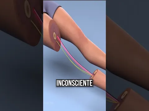 Como funciona uma cirurgia? #shorts
