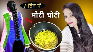 हफ्ते में बस 1 बार लगा लो, बाल तीर की तरह लंबे होंगे | Hair Growth challenge
