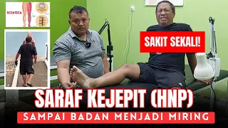 SARAF KEJEPIT (HNP) SAMPAI BADAN MENJADI MIRING SAKIT SEKALI