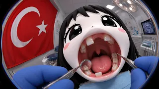 турецкий скам на зубы