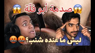 طبيب يجاوب : ليش أبو فلّة ما عنده شنب ، وردة فعل أبو فلّة (انصدم)