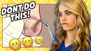 Doctor reacts: Ingrown nail gone wrong