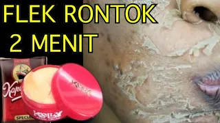 BEDAK AJAIB!!  FLEK HITAMMU ,KRIPUT, KUSAM RONTOK TOTAL SECEPAT 2 MENIT/ WAJAH LANGSUNG GLOW UP!!