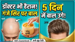 डॉक्टर भी हैरान! गंजे सिर पर बाल उगाने का देसी तरीका 😱