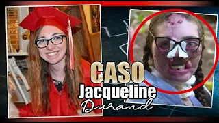 Dos PERROS le MORDIERON 800 veces la CARA y VIVIÓ un INFIERNO