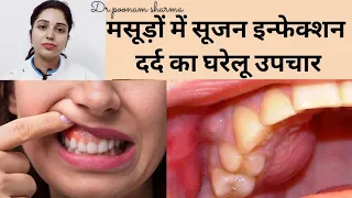 मसूड़ों में Infection, दर्द और सूजन का घरेलू इलाज|| masudon ki sabhi problem ka gharelu ilaj||