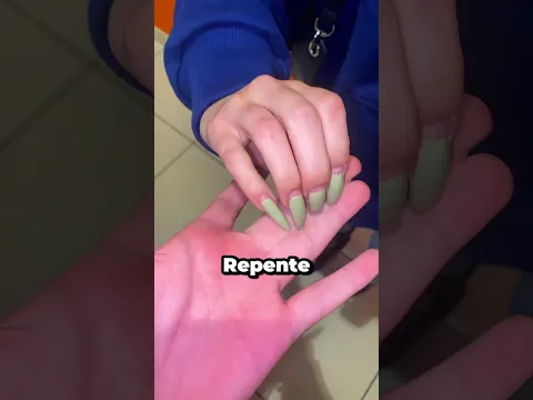 ¿Cómo se pusieron así los dedos? 😨🤔