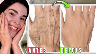 O Melhor para MÃOS SECAS com RUGAS e MANCHAS!