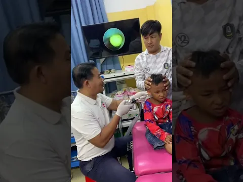 Kid’s Ear Bead Removal 👂✨ | Amazing ENT Endoscopic View #ENT #DoctorLife