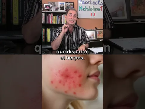 Manejando El Herpes