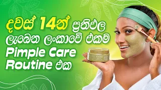 දවස් 14න් ප්‍රතිඵල ලැබෙන ලංකාවේ එකම Pimple Care Routine | Pimple Removal at Home | Skin Care Expert
