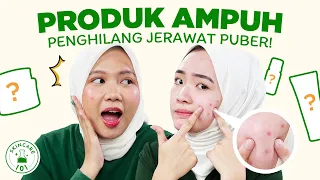 Jerawat Puber Bikin Minder? Ini Produk untuk Menghilangkan Jerawat!