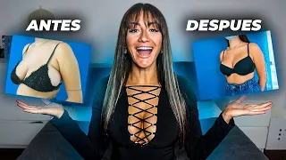 MI OPERACIÓN DE PECHO ¿ME HE PUESTO PRÓTESIS? PREGUNTAS Y RESPUESTAS POSTOPERATORIO | FatiVázquez