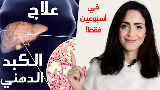 الكبد الدهني | علاج الكبد الدهني بدون ادويه في اسبوعين