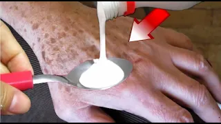 ATÉ MEU PAI FICOU COM MÃOS DE MOCINHO...DESAPREGA TUDO ATÉ RUGA NA MÃO