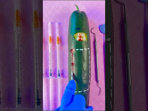 Why Do the End of these Food Surgeries Make Me Cry? 😭💔🤧