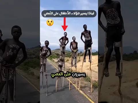 طريقة غريبة في المشي، لماذا؟ 😲😲