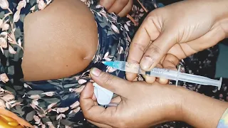 IM Intramuscular Arm injection Hydrocortisone  injection Tutorial.  24 Ep 91 Anik Health Tips