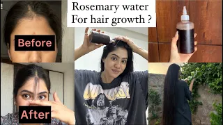 Best Lost hair regrowth remedy 😱 (visible results with proof)