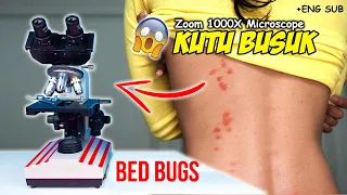 PENAMPAKAN KUTU BUSUK DI MIKROSKOP | Bed Bugs Under Microscope Zoom 1000X