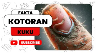 TERUNGKAP ❗Fakta Sebenarnya dari Kuku Kotor