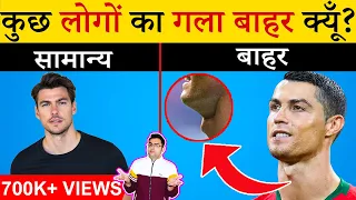 कुछ लोगों का गला बाहर क्यूँ होता है? | Most Amazing Facts| Random Facts in Hindi | TFS EP 163
