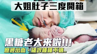 【大姐肚子三度開箱】黑糖老大降肉！歷經出血、確診、安胎種種困難..