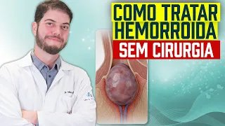 Como tratar hemorroida sem cirurgia!