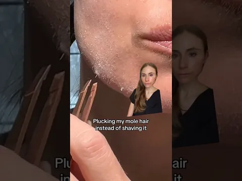 Plucking A Mole Hair #dermatologist