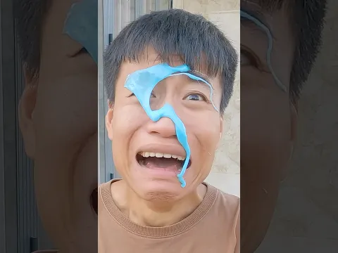 ACC - Cô Bé Giả Vờ Chảy Nước Mũi Troll Mọi Người || Little Girl Trolling Everyone With Runny Nose.