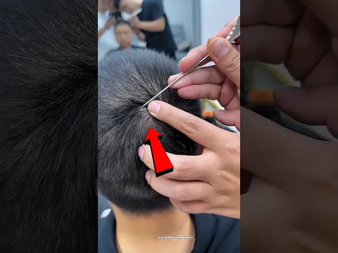 لن تصدق ما على رأسه! 🤯 #shorts #viral#shortvideo