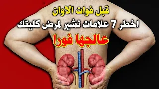 اخطر 7 علامات مبكره تخبرك بمرض الكلى عالجها فورا