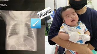 PAANO NAGKA PULMONYA SI BABY KHALIX