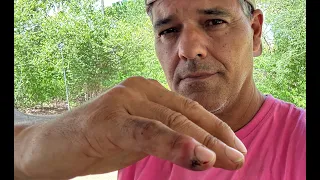 Me muerde serpiente venenosa