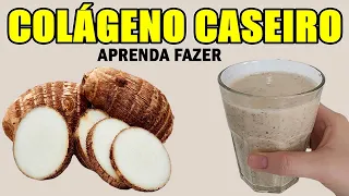 COLÁGENO CASEIRO PARA OSSOS FORTES, PREVENIR VARIZES E TROMBOSE