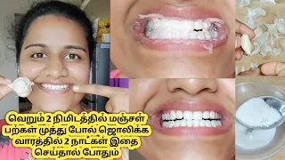 வெறும் 2 நிமிடத்தில் மஞ்சள் பற்களை வெள்ளை‌ பற்களாக மாற்ற வாரத்தில் 2 நாட்கள் செய்தால் போதும்
