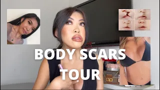 BODY SCAR TOUR | JENNIFERNGO