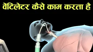वेंटिलेटर क्या है और ये कैसे काम करता हैं? ज़िंदगी बचाने वाली मशीन का पूरा सच!- ventilator in hindi