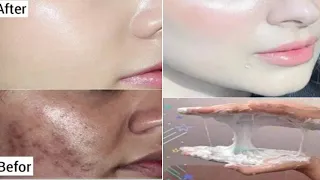 أقوي وصفه لتبييض تخلي وجهك وجسمك كيف المرايا بياض كاثلج