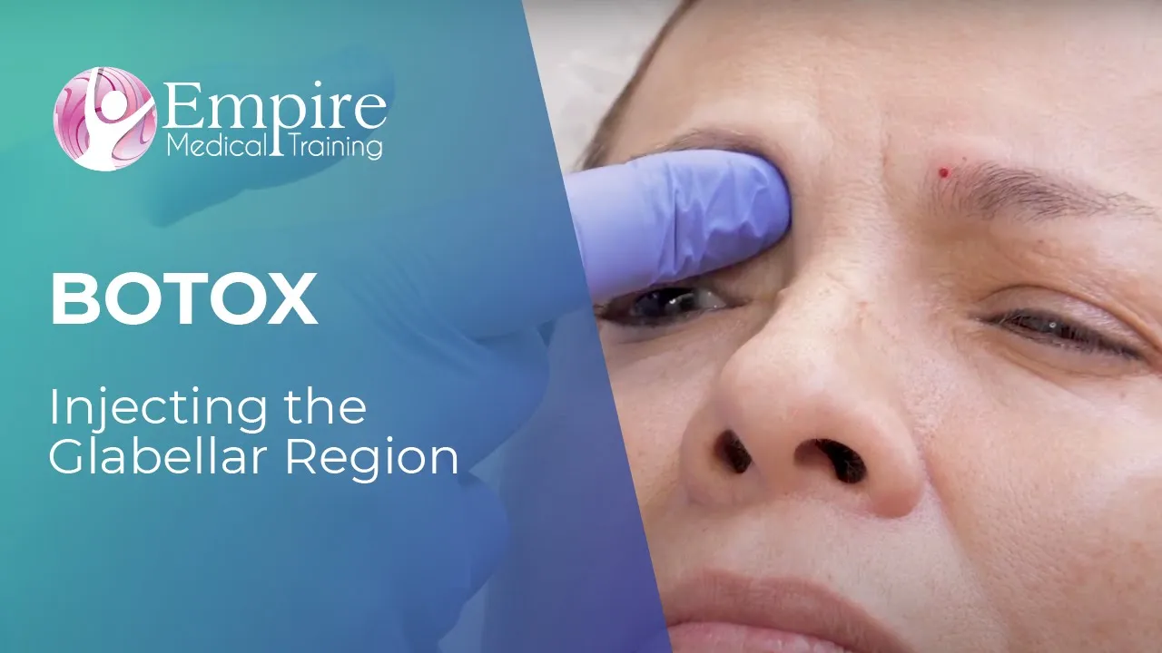 Botox Forehead Injections—The Glabellar video