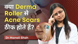 क्या Derma Roller से Acne Scars ठीक होते हैं? | Is it the Secret to Perfect Skin? | Clear Skin, Pune