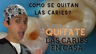como puedo quitarme las caries sin ir al dentista